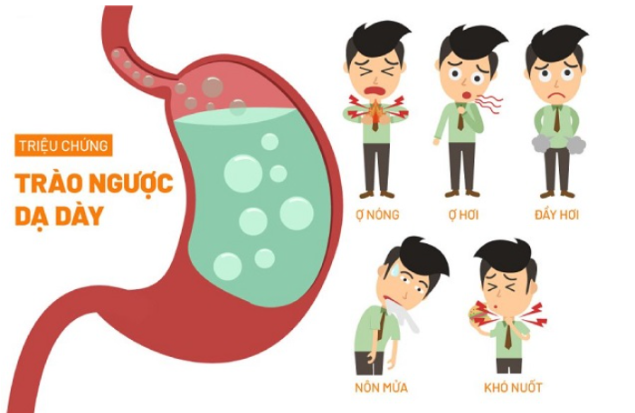 Triệu chứng trào ngược dạ dày